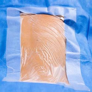 Laminectomy Drape